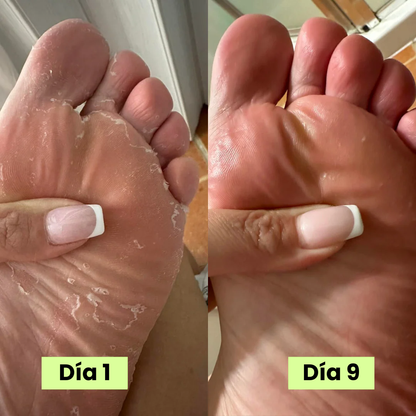 Serena® Jabón eliminador de hongos