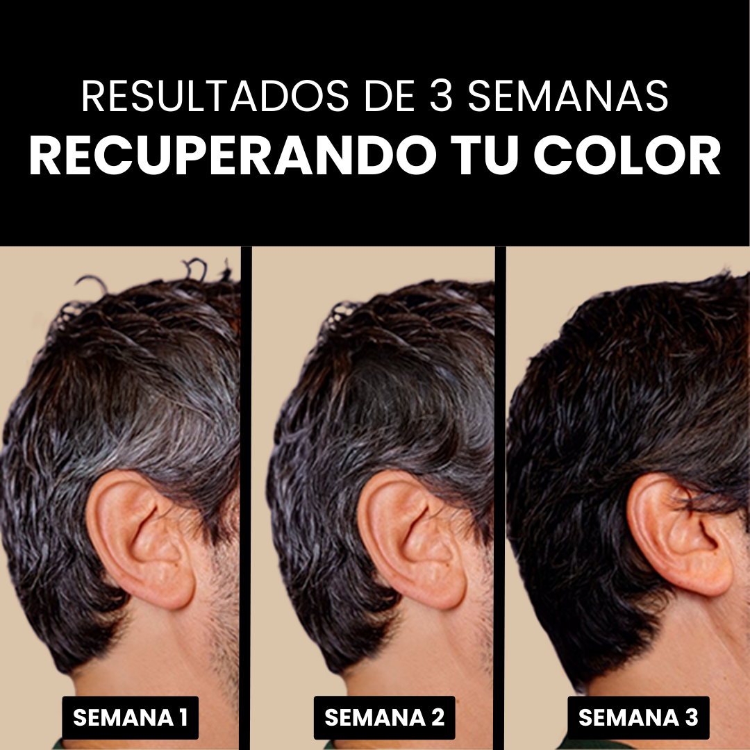 Jabón Anti Canas Serena™