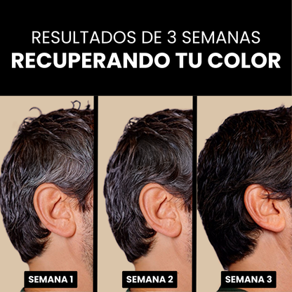 Jabón Anti Canas Serena™