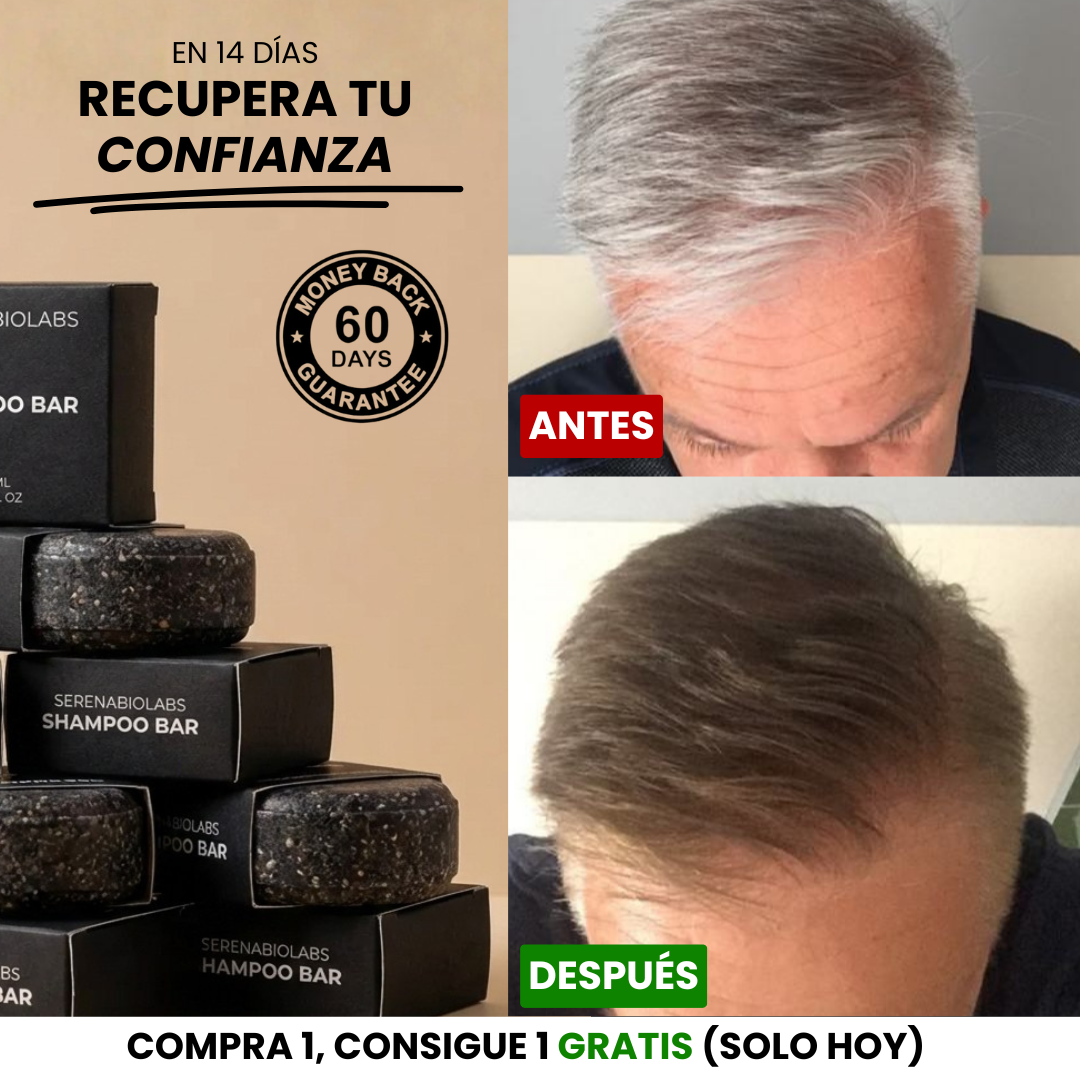 Jabón Anti Canas Serena™