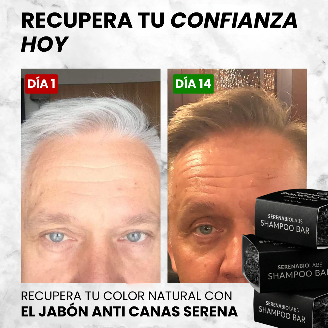 Jabón Anti Canas Serena™