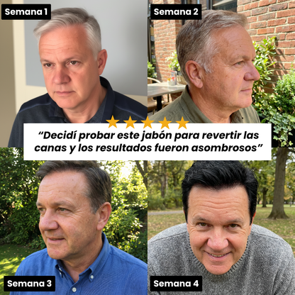 Jabón Anti Canas Serena™