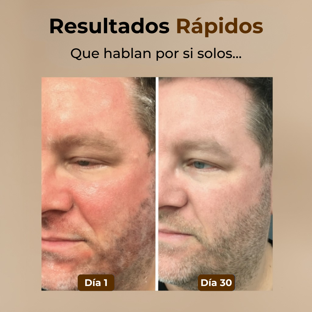 Crema Reparadora Serena™