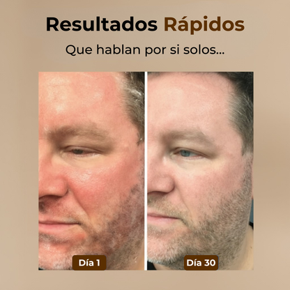 Crema Reparadora Serena™