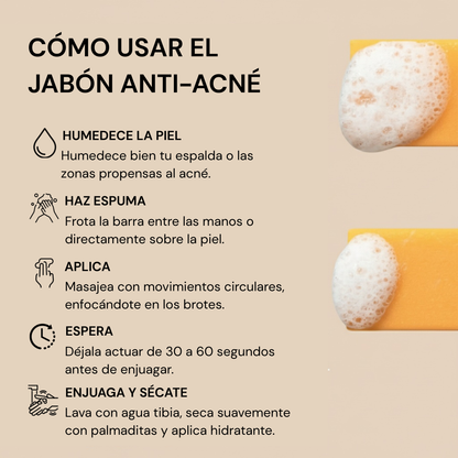 Jabón Anti Acné Serena™