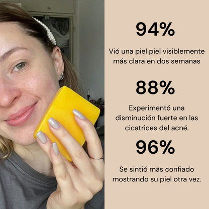 Jabón Anti Acné Serena™